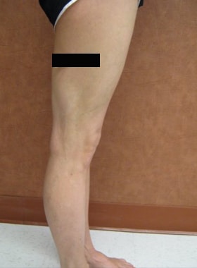 After Image: Pregnancy - right-side