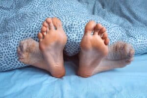 Restless leg syndrome