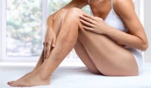 Woman with varicose veins and restless leg syndrome in Geneva, IL