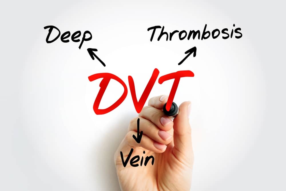Dvt,-,Deep,Vein,Thrombosis,Acronym,,Medical,Concept,Background Deep Vein Thrombosis in Geneva & Elk Grove Village, IL