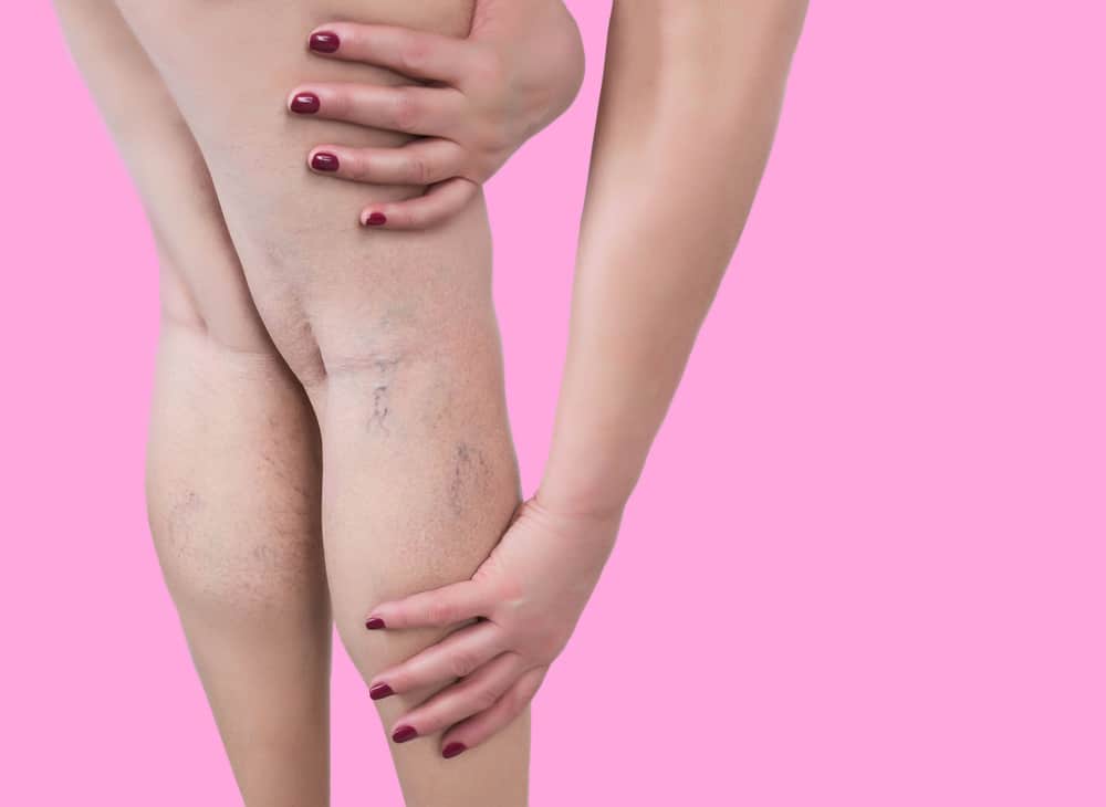 The,Old,Age,And,Sick,Of,A,Woman.,Varicose,Veins Poorly Healing Leg Wound in Geneva & Elk Grove Village, IL